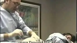VASER Liposelection