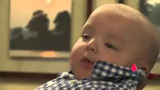Rh Disease leads to 28 transfusions for baby Mack