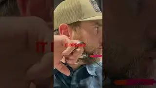 Ultraview Hinge Set Too Cold