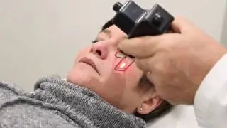 Laser Frazionale - Trattamenti Antiaging Urban Medical Beauty