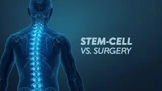 Can Stem Cells Prevent Surgery? The Truth About Regenerative Medicine, Ep.  64
