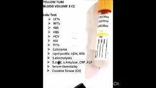 #Blood test tubes #uses #colors #causes #knowledge #lab #trending #medicalstudent #injection