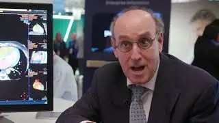 Challenges in cardiac imaging postprocessing