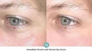 Nerium Anti-Aging Eye Serum - Product Review