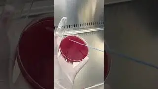 Pus Culture: Identifying Infections for Better Treatment | Lab Testing Explained #lab #shortvideo