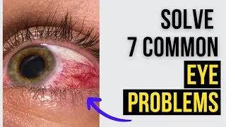 7 Common Eye Problems and How to Treat Them Naturally