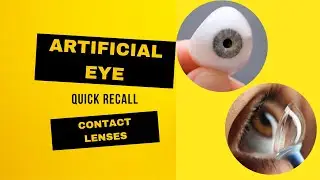 Special Contact lens, RGP, Mini Scleral, and Artificial eye #glimpse  #contactlens #artificialeye