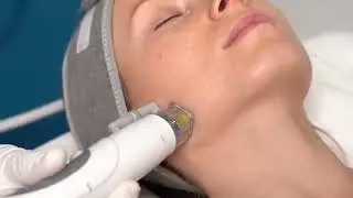 Nubway--vacuum Fractional RF microneedling machine-TRF6