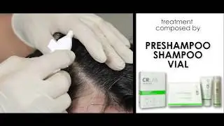 CRLAB Green Line - Hair Loss prevention