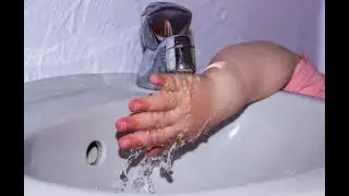 Hot water danger