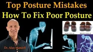 Top Posture Mistakes - How to Fix Your Poor Posture  (Dr Mandell Live Stream)