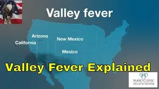 Valley Fever Explained the What Is via Health Matters