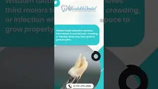 Pain-Free Wisdom Tooth Removal | Affordable Dental Care!