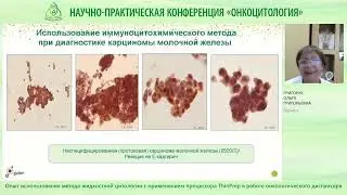 Опыт использования метода жидкостной цитологии с применением процессора ThinPrep