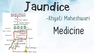 Jaundice General Medicine