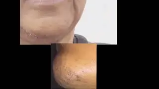 Chinny, Chin, Chin 