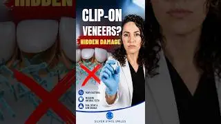 The Problems With Clip On Veneers!