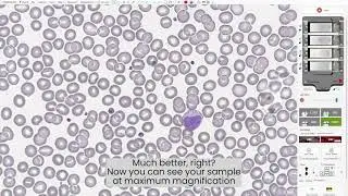 NED DH - Demo of RBC (Red Blood Cells) software analysis
