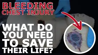 How to use a chest seal in an emergency medical situation
