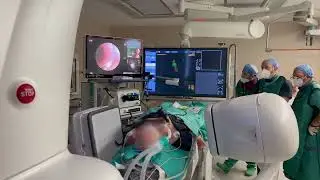Mini Probe Radial 360 SP-900 by Fujifilm at Athens Medical Center