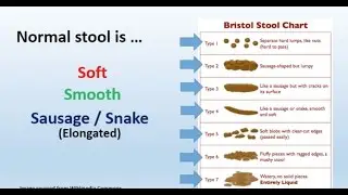 Watery Stool &ndash; Causes of Liquid, Fluid Bowel Movement, Feces