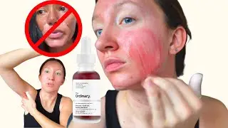How Not to Ruin Your Skin with The Ordinary Peeling Solution 🚫 3 most common mistakes