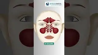 Understanding Chronic Sinusitis &ndash; Symptoms, Causes & When to Seek Treatment