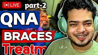 Braces QnA Video LIVE Part-2 | My Braces Journey | | #bracestreatment  #braces  #bracesupdate