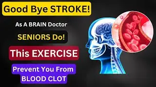 SHOCKING! 10 Best Exercises to Prevent Stroke Risk After 50 | Elevate Health