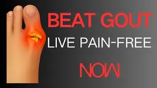 Gout Relief for Seniors The Ultimate Guide to Natural Uric Acid Control & Pain Free Living