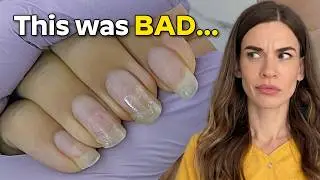 My Nails Were a Mess… So I Fixed Them