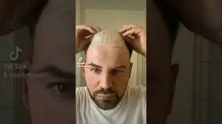 How to install thin skin base Toupee by yourself 😁