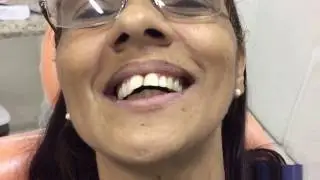DEPOIMENTO PACIENTE PRÓTESE FLEXÍVEL CLÍNICA DO TRABALHADOR
