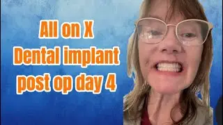 All on X post op update 