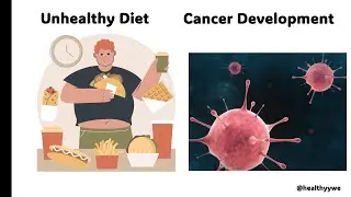 Unhealthy diet and cancer development@healthyywe