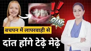टेढ़े मेढ़े दाँत #Treatment of baby teeth #बच्चों के दांतों का दर्द #myths about baby teeth 