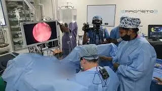 Live HoLEP Demonstration Using Quanta Magneto | Dr. Fernando G&oacute;mez-Sancha