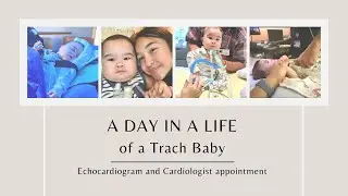 ECHOCARDIOGRAM AND CARDIOLOGIST APPOINTMENT | A DAY IN A LIFE OF A TRACH BABY |NICU BABY