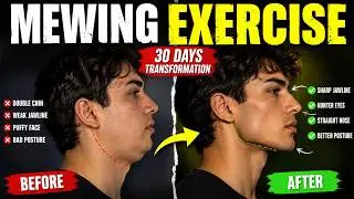 Expert Mewing Exercise By Dr. Mike Mew