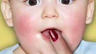 Baby Teething Basics (Baby Health Guru)