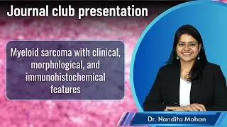 Journal Club: Myeloisches Sarkom &ndash; Die klinischen, morphologischen und immunhistochemischen Merkmale