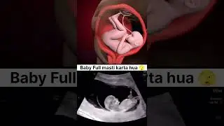 Baby Full masti #baby #ultrasound #pregnant #viral #pregnancyjourney #pregnancy #shorts