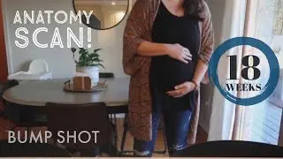 18 Week Pregnancy Update! [BABY #3]