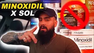 MINOXIDIL NO VER&Atilde;O, N&Atilde;O PEGUE SOL! | BARBA PRETA