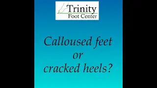 We Offer Creams That Help With Your Calloused Feet!