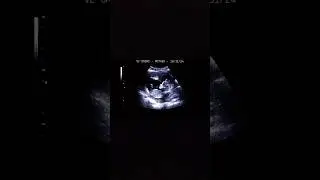 The first pregnant trans woman 🥹
