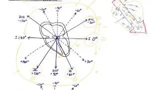 Cardiac Axis & Axis Deviation