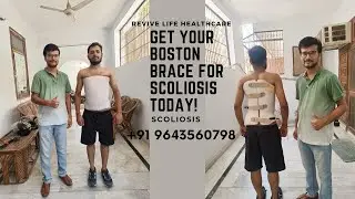 Bracing for Scoliosis I Boston Brace I Spinal Brace I Scoliosis I Deviation I Correction I Deformity