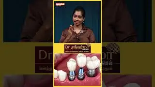 Dental Implant Failure ஆக வாய்ப்பு இருக்கா ? | Dr. Subhashini Reuban#shorts