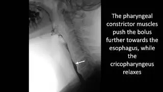Swallowing disorders - Normal swallowing